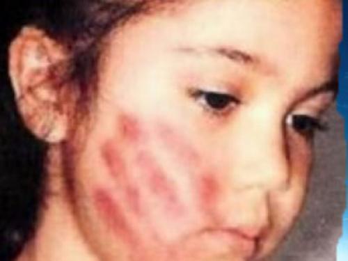 http://www.enlineadirecta.info/fotos/Violencia_bofetada%5B1%5D.jpg